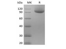 NRP1 / Neuropilin 1 Protein - Recombinant Human Neuropilin-1/NRP1 (C-Avi-6His) Biotinylated