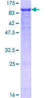 NRP1 / Neuropilin 1 Protein - 12.5% SDS-PAGE of human NRP1 stained with Coomassie Blue