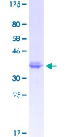 NRP1 / Neuropilin 1 Protein - 12.5% SDS-PAGE Stained with Coomassie Blue.