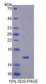 NRP1 / Neuropilin 1 Protein - Recombinant Neuropilin 1 By SDS-PAGE