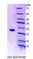 NRP1 / Neuropilin 1 Protein - Recombinant Neuropilin 1 By SDS-PAGE