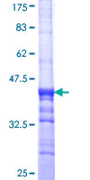 NRP2 / Neuropilin 2 Protein - 12.5% SDS-PAGE Stained with Coomassie Blue.