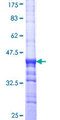 NRP2 / Neuropilin 2 Protein - 12.5% SDS-PAGE Stained with Coomassie Blue.