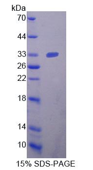 NRP2 / Neuropilin 2 Protein - Recombinant  Neuropilin 2 By SDS-PAGE