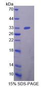 NRP2 / Neuropilin 2 Protein - Recombinant  Neuropilin 2 By SDS-PAGE