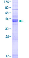 NRSN1 Protein - 12.5% SDS-PAGE of human NRSN1 stained with Coomassie Blue