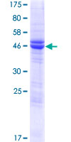 NRSN2 Protein - 12.5% SDS-PAGE of human NRSN2 stained with Coomassie Blue