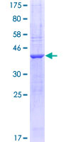 NRXN1 / Neurexin 1 Protein - 12.5% SDS-PAGE Stained with Coomassie Blue.