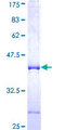 NRXN3 Protein - 12.5% SDS-PAGE Stained with Coomassie Blue.