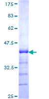 NSD1 Protein - 12.5% SDS-PAGE Stained with Coomassie Blue.