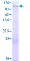 NSD3 / WHSC1L1 Protein - 12.5% SDS-PAGE of human WHSC1L1 stained with Coomassie Blue