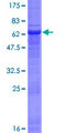 NSDHL Protein - 12.5% SDS-PAGE of human NSDHL stained with Coomassie Blue