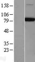 NSF Protein - Western validation with an anti-DDK antibody * L: Control HEK293 lysate R: Over-expression lysate