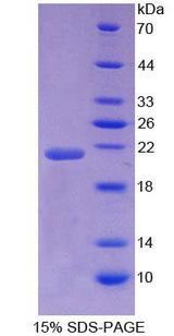 NSF Protein - Recombinant  N-Ethylmaleimide Sensitive Factor By SDS-PAGE