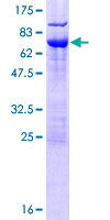 NSFL1C Protein - 12.5% SDS-PAGE of human NSFL1C stained with Coomassie Blue