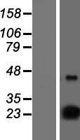 NSG1 Protein - Western validation with an anti-DDK antibody * L: Control HEK293 lysate R: Over-expression lysate