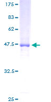 NSG1 Protein - 12.5% SDS-PAGE of human D4S234E stained with Coomassie Blue