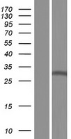 NSL1 Protein - Western validation with an anti-DDK antibody * L: Control HEK293 lysate R: Over-expression lysate