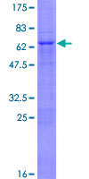 NSL1 Protein - 12.5% SDS-PAGE of human C1orf48 stained with Coomassie Blue