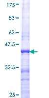 NSL1 Protein - 12.5% SDS-PAGE Stained with Coomassie Blue.