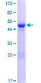 NSMCE1 Protein - 12.5% SDS-PAGE of human NSMCE1 stained with Coomassie Blue