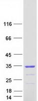 NSMCE1 Protein - Purified recombinant protein NSMCE1 was analyzed by SDS-PAGE gel and Coomassie Blue Staining