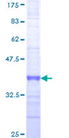 NSPC1 / PCGF1 Protein - 12.5% SDS-PAGE Stained with Coomassie Blue.