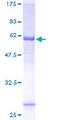 NSUN3 Protein - 12.5% SDS-PAGE of human NSUN3 stained with Coomassie Blue