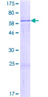 NSUN4 Protein - 12.5% SDS-PAGE of human NSUN4 stained with Coomassie Blue