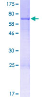 NSUN5 Protein - 12.5% SDS-PAGE of human NSUN5 stained with Coomassie Blue