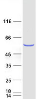 NSUN6 Protein - Purified recombinant protein NSUN6 was analyzed by SDS-PAGE gel and Coomassie Blue Staining