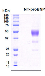 NT-proBNP Protein - SDS-PAGE under reducing conditions and visualized by Coomassie blue staining