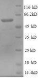NT5C1A / CN1A Protein - (Tris-Glycine gel) Discontinuous SDS-PAGE (reduced) with 5% enrichment gel and 15% separation gel.
