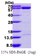 NT5C2 Protein
