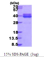 NT5C3B / NT5C3L Protein