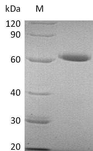 NT5E / eNT / CD73 Protein - (Tris-Glycine gel) Discontinuous SDS-PAGE (reduced) with 5% enrichment gel and 15% separation gel.