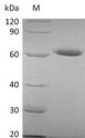 NT5E / eNT / CD73 Protein - (Tris-Glycine gel) Discontinuous SDS-PAGE (reduced) with 5% enrichment gel and 15% separation gel.
