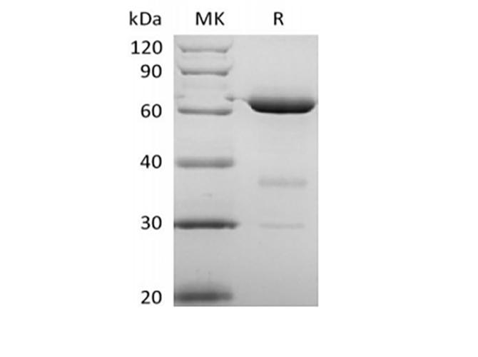 NT5E / eNT / CD73 Protein - Recombinant Human 5'-Nucleotidase/5'-NT/CD73 (P21589, C-6His)