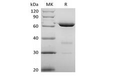 NT5E / eNT / CD73 Protein - Recombinant Human 5'-Nucleotidase/5'-NT/CD73 (P21589, C-6His)