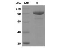NT5E / eNT / CD73 Protein - Recombinant Human 5'-Nucleotidase/5'-NT/CD73 (AAH65937.1, C-Fc)