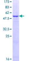 NT5E / eNT / CD73 Protein - 12.5% SDS-PAGE of human NT5E stained with Coomassie Blue