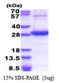 NT5E / eNT / CD73 Protein