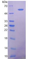 NT5E / eNT / CD73 Protein - Active 5'-Nucleotidase, Ecto (NT5E) by SDS-PAGE