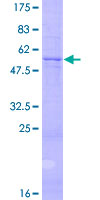 NTF3 / Neurotrophin 3 Protein - 12.5% SDS-PAGE of human NTF3 stained with Coomassie Blue