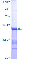 NTF3 / Neurotrophin 3 Protein - 12.5% SDS-PAGE Stained with Coomassie Blue.