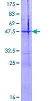 NTF4 / Neurotrophin 4 Protein - 12.5% SDS-PAGE of human NTF5 stained with Coomassie Blue