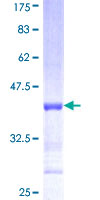 NTF4 / Neurotrophin 4 Protein - 12.5% SDS-PAGE Stained with Coomassie Blue.