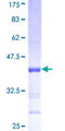 NTF4 / Neurotrophin 4 Protein - 12.5% SDS-PAGE Stained with Coomassie Blue.