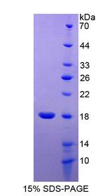 NTF4 / Neurotrophin 4 Protein - Recombinant Neurotrophin 4 By SDS-PAGE