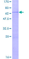 NTHL1 Protein - 12.5% SDS-PAGE of human NTHL1 stained with Coomassie Blue